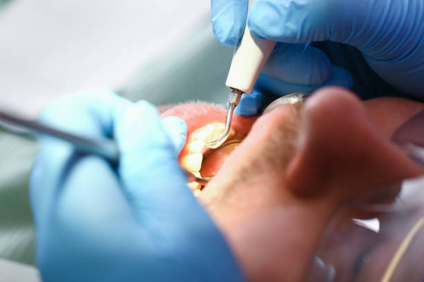 Best Emergency Gum Treatment in Cedar Crest, MA